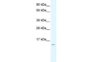 WB Suggested Anti-CCL7 Antibody Titration:  0. (CCL7 抗体  (N-Term))