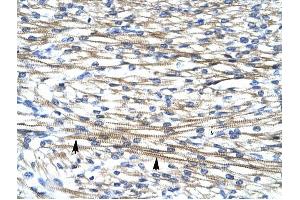 FHL2 antibody was used for immunohistochemistry at a concentration of 4-8 ug/ml to stain Myocardial cells (arrows) in Human Heart. (FHL2 抗体  (C-Term))