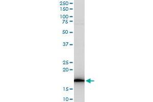 RPS17 polyclonal antibody (A03), Lot # 060529JCS1. (RPS17 抗体  (AA 36-135))