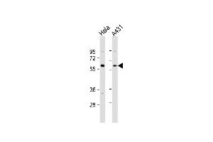 All lanes : Anti-Beclin-1 Antibody  at 1:4000 dilution Lane 1: Hela whole cell lysate Lane 2: A431 whole cell lysate Lysates/proteins at 20 μg per lane. (Beclin 1 抗体  (AA 210-239))
