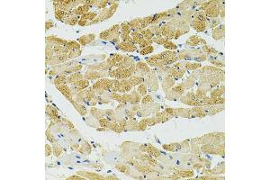 Immunohistochemistry of paraffin-embedded rat heart using RALBP1 antibody (ABIN5970488) at dilution of 1/100 (40x lens). (RALBP1 抗体)