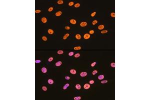 Immunofluorescence analysis of NIH-3T3 cells using hnRNP U Rabbit mAb (ABIN1679689, ABIN3018741, ABIN3018742 and ABIN7101656) at dilution of 1:100 (40x lens).