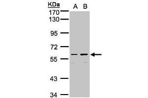 WB Image Sample (30μg whole cell lysate) A:Hep G2 , B:MOLT4 , 7. (CCDC102B 抗体)