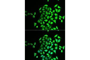 Immunofluorescence analysis of U2OS cells using NAPG antibody. (NAPG 抗体  (AA 1-312))