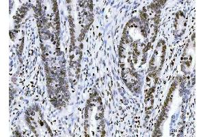 IHC analysis of HMGN2 using anti-HMGN2 antibody (ABIN6719576).