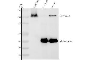 Immunoprecipitating SMARCAD1 in K562 whole cell lysate.