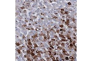 Immunohistochemical staining of human liver with C1orf68 polyclonal antibody  shows strong cytoplasmic positivity in subset of hepatocytes at 1:50-1:200 dilution. (C1orf68 抗体)