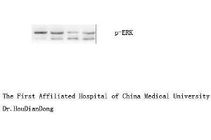 Western Blot (WB) analysis: Please contact us for more details. (ERK1/2 抗体  (pTyr204))