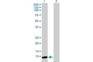 Western Blot analysis of ARL9 expression in transfected 293T cell line by ARL9 MaxPab polyclonal antibody. (ARL9 抗体  (AA 1-123))