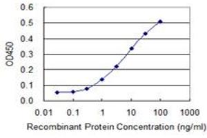 Detection limit for recombinant GST tagged LMTK3 is 0. (LMTK3 抗体  (AA 1151-1250))