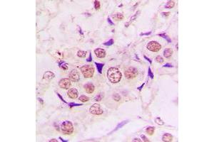 Immunohistochemistry (IHC) image for anti-Zinc Finger CCCH-Type Containing 8 (ZC3H8) (Center) antibody (ABIN7298448)
