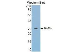 Detection of Recombinant CTSK, Simian using Monoclonal Antibody to Cathepsin K (CTSK) (Cathepsin K 抗体  (AA 116-329))