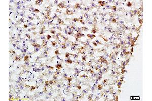 Formalin-fixed and paraffin embedded rat liver labeled with Anti-PCK2 Polyclonal Antibody, Unconjugated (ABIN708206) at 1:200 followed by conjugation to the secondary antibody and DAB staining