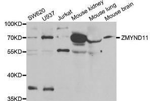 Western Blotting (WB) image for anti-Zinc Finger, MYND-Type Containing 11 (ZMYND11) antibody (ABIN1980343) (ZMYND11 抗体)