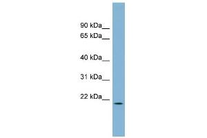 WB Suggested Anti-C4orf28 Antibody Titration: 0. (PACRGL 抗体  (Middle Region))