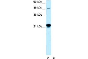 WB Suggested Anti-LASS2 Antibody Titration:  0. (Ceramide Synthase 2 抗体  (N-Term))