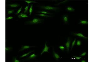 Immunofluorescence of monoclonal antibody to CALCOCO2 on HeLa cell. (CALCOCO2 抗体  (AA 347-446))
