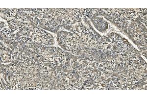 IHC analysis of Carbonic Anhydrase I/CA1 using anti-Carbonic Anhydrase I/CA1 antibody (ABIN7602621).