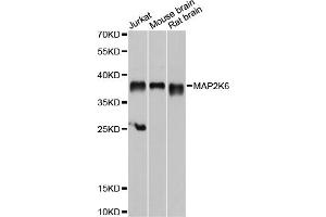 Western blot analysis of extracts of various cell lines, using MAP2K6 antibody. (MAP2K6 抗体)
