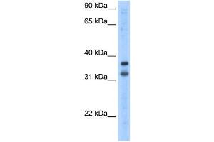 WB Suggested Anti-KCNRG Antibody Titration:  2. (KCNRG 抗体  (N-Term))