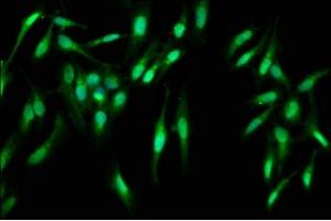 Immunofluorescence staining of Hela cells with ABIN7146938 at 1:400, counter-stained with DAPI. (Caspase 2 抗体  (AA 2-452))