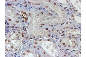 Immunohistochemical staining of paraffin-embedded Human Kidney tissue using anti-ELK3 mouse monoclonal antibody. (ELK3 抗体)