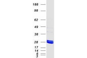 Western Blotting (WB) image for Methylmalonic Aciduria (Cobalamin Deficiency) CblB Type (MMAB) protein (Myc-DYKDDDDK Tag) (ABIN2726122)