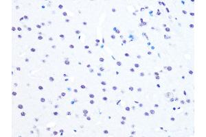 Immunohistochemistry of paraffin-embedded mouse brain using NUM Rabbit mAb (ABIN7269002) at dilution of 1:100 (40x lens). (NUMA1 抗体)