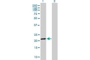 Western Blot analysis of SYT16 expression in transfected 293T cell line by SYT16 MaxPab polyclonal antibody. (SYT16 抗体  (AA 1-203))