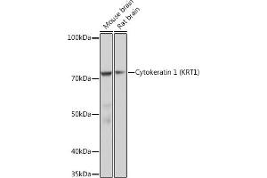 Western blot analysis of extracts of various cell lines, using Cytokeratin 1 (KRT1) (KRT1) Rabbit mAb (ABIN7268085) at 1:1000 dilution. (Cytokeratin 1 抗体)