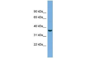 WB Suggested Anti-CRYM Antibody Titration: 0. (CRYM 抗体  (N-Term))