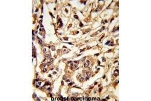 Immunohistochemistry (IHC) image for anti-Galactose-1-Phosphate Uridylyltransferase (GALT) antibody (ABIN3002853) (GALT 抗体)
