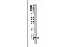 Image no. 1 for anti-Small Ubiquitin Related Modifier 4 (SUMO4) (Middle Region) antibody (ABIN356785) (SUMO4 抗体  (Middle Region))