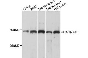 Western blot analysis of extracts of various cell lines, using CACNA1E antibody. (CACNA1E 抗体  (AA 2014-2313))