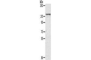 Gel: 6 % SDS-PAGE, Lysate: 40 μg, Lane: MCF7 cells, Primary antibody: ABIN7131203(STAG2 Antibody) at dilution 1/300, Secondary antibody: Goat anti rabbit IgG at 1/8000 dilution, Exposure time: 5 seconds (STAG2 抗体)