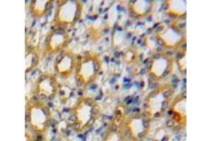 Used in DAB staining on fromalin fixed paraffin-embedded Kidney tissue (ADAMTS1 抗体  (AA 476-614))