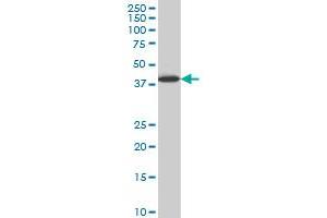 LHX6 monoclonal antibody (M05), clone 3E8 Western Blot analysis of LHX6 expression in HepG2 . (LHX6 抗体  (AA 274-363))