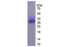 SDS-PAGE analysis of Mouse SOSTDC1 Protein. (SOSTDC1 蛋白)