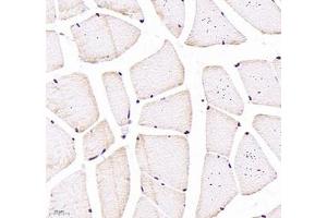 Immunohistochemistry of paraffin embedded rat skeletal muscle using CNG1 (ABIN7073608) at dilution of 1:700 (400x lens) (CNGA1 抗体)
