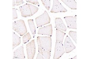 Immunohistochemistry of paraffin embedded rat skeletal muscle using CNG1 (ABIN7073608) at dilution of 1:700 (400x lens)