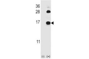 Western blot analysis of FABP4 antibody and 293 cell lysate (2 ug/lane) either nontransfected (Lane 1) or transiently transfected (2) with the FABP4 gene.