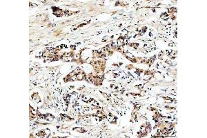 IHC analysis of USP5 using anti-USP5 antibody (ABIN7599551). (USP5 抗体  (AA 1-800))