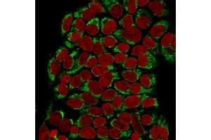 Immunofluorescence Analysis of Human MCF-7 cells labeling GnRH-R with GnRH-Receptor Mouse Monoclonal Antibody (F1G4) followed by Goat anti-mouse IgG-CF488 (Green). (GNRHR and LHCGR (AA 1-29), (N-Term) 抗体)
