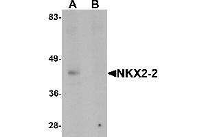 Western blot analysis of NKX2-2 in rat kidney tissue lysate with NKX2-2 antibody at 1 µg/mL in (A) the absence and (B) the presence of blocking peptide. (Nkx2-2 抗体  (Middle Region))