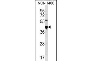 CEAC Antibody (N-term) (ABIN656216 and ABIN2845533) western blot analysis in NCI- cell line lysates (35 μg/lane). (CEACAM18 抗体  (N-Term))