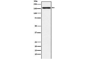 Western blot analysis of Desmoglein 2 expression in HeLa cell lysate.