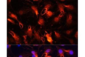 Immunofluorescence analysis of C6 cells using RNF149 Polyclonal Antibody at dilution of 1:100 (40x lens). (RNF149 抗体)