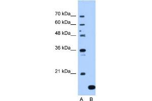 NAT13 antibody used at 1. (NAA50 抗体  (C-Term))