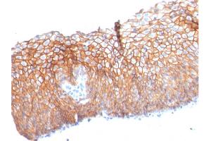 Immunohistochemistry (IHC) image for anti-Desmoglein 3 (DSG3) (AA 379-491) antibody (ABIN6939268)