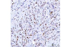IHC analysis of Cdk2 using anti-Cdk2 antibody (ABIN7602522).